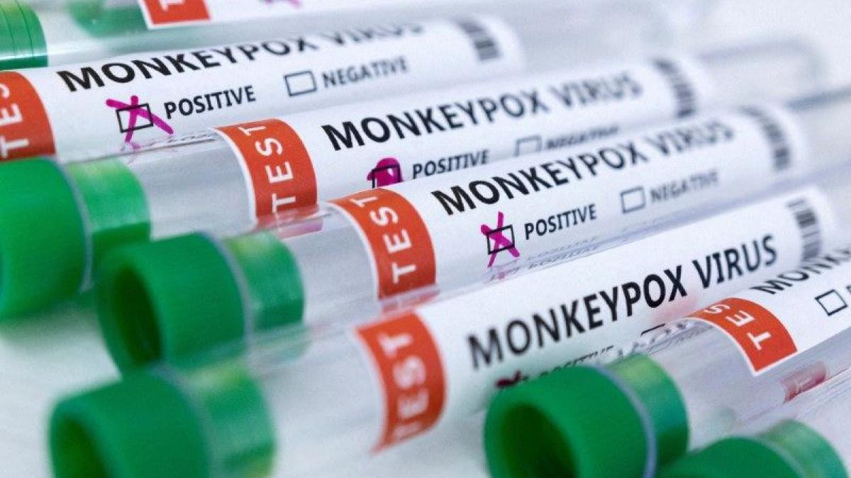 Africa CDC says gay sex "not relevant'' in monkeypox there (Photo: Reuters)