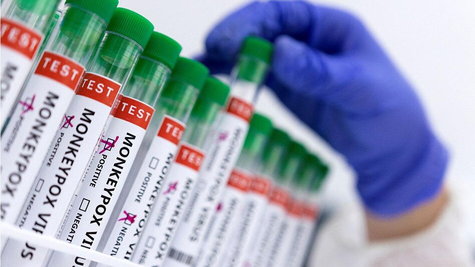 India reports first monkeypox death in Asia India reports first monkeypox death in Asia