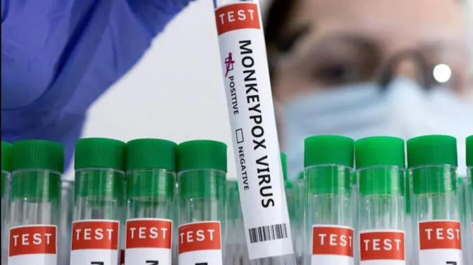 California governor declares monkeypox emergency California governor declares monkeypox emergency