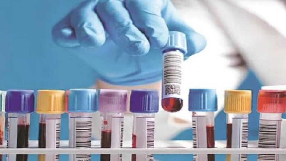 Dr Lal PathLabs share price: The stock hit an intraday low of Rs 2,395.35 on BSE today. Dr Lal PathLabs share price: The stock hit an intraday low of Rs 2,395.35 on BSE today.