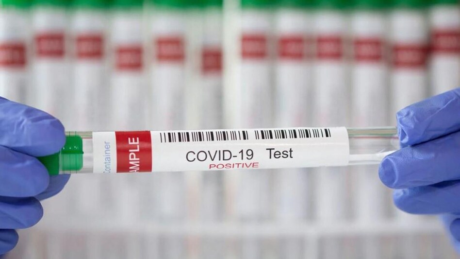 China is currently facing a massive surge in Covid cases. India has asked all the states to send all positive cases for genome sequencing to track new variants if any. China is currently facing a massive surge in Covid cases. India has asked all the states to send all positive cases for genome sequencing to track new variants if any.