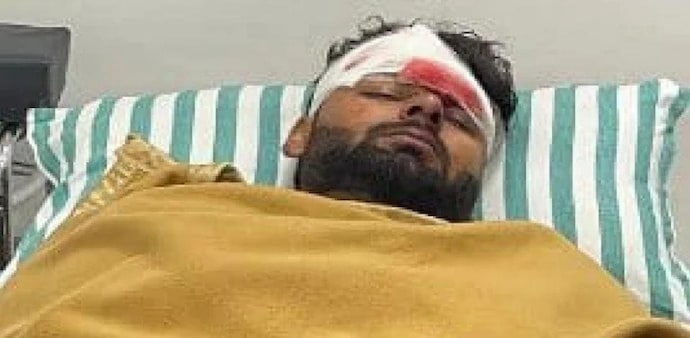 Rishabh Pant has received two cuts on his forehead, a ligament tear in his right knee and has also hurt his right wrist, ankle, toe, and suffered abrasion injuries on his back. Rishabh Pant has received two cuts on his forehead, a ligament tear in his right knee and has also hurt his right wrist, ankle, toe, and suffered abrasion injuries on his back.
