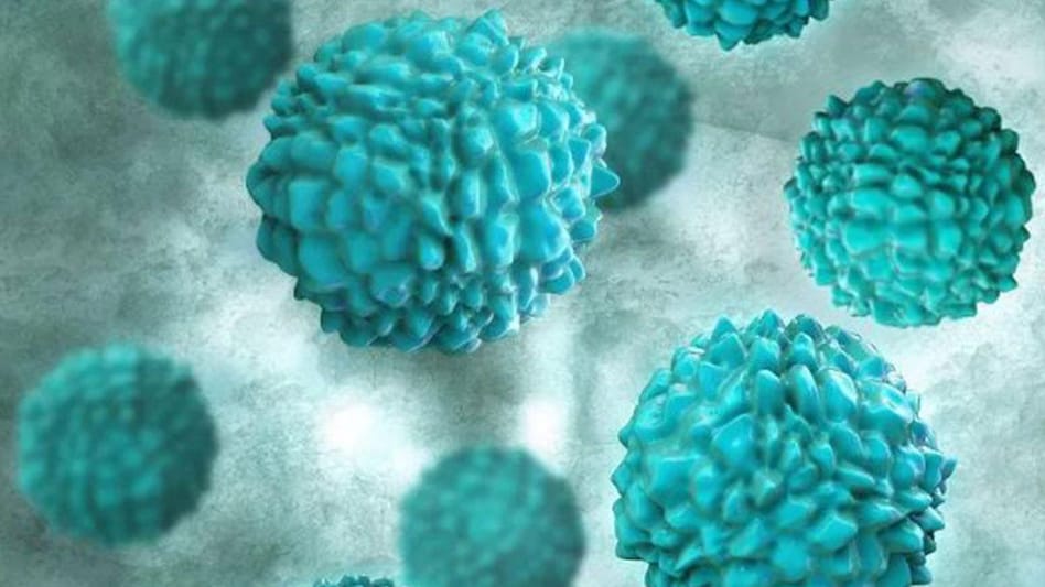 Norovirus is a viral illness that is the most common cause of acute gastroenteritis globally. Norovirus is a viral illness that is the most common cause of acute gastroenteritis globally.