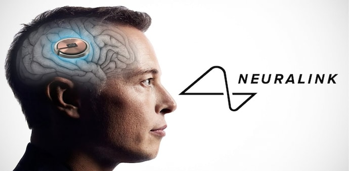 Neuralink Neuralink