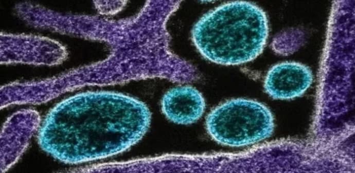 Karnataka issues circular amid Nipah scare in Kerala Karnataka issues circular amid Nipah scare in Kerala