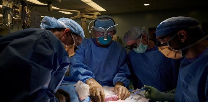 Doctors transplanted the modified kidney and thymus gland of a pig into Miller’s body on July 14, days before his 58th birthday. Doctors transplanted the modified kidney and thymus gland of a pig into Miller’s body on July 14, days before his 58th birthday.