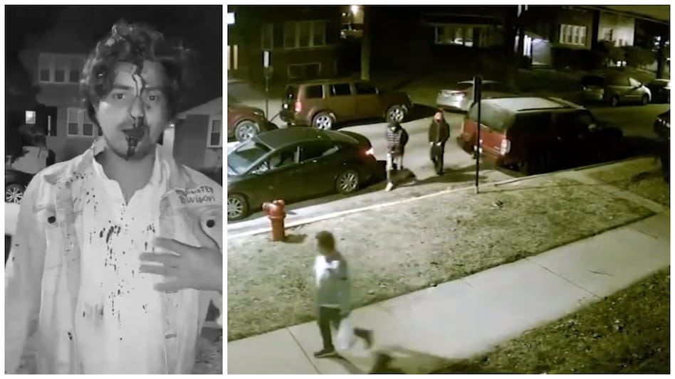 Indian student attacked in Chicago narrates his horrifying ordeal Indian student attacked in Chicago narrates his horrifying ordeal