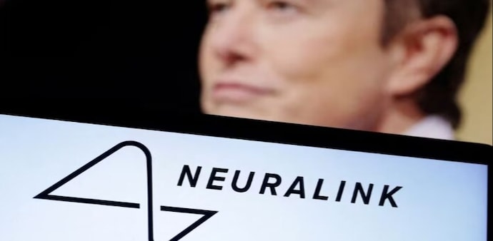 Neuralink Neuralink