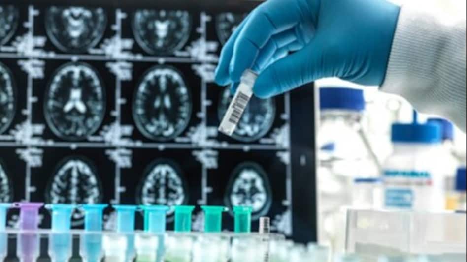 Alkem Labs shares were down 7.56 per cent apiece to trade at Rs 5,009.70 apiece on the BSE. Alkem Labs shares were down 7.56 per cent apiece to trade at Rs 5,009.70 apiece on the BSE.