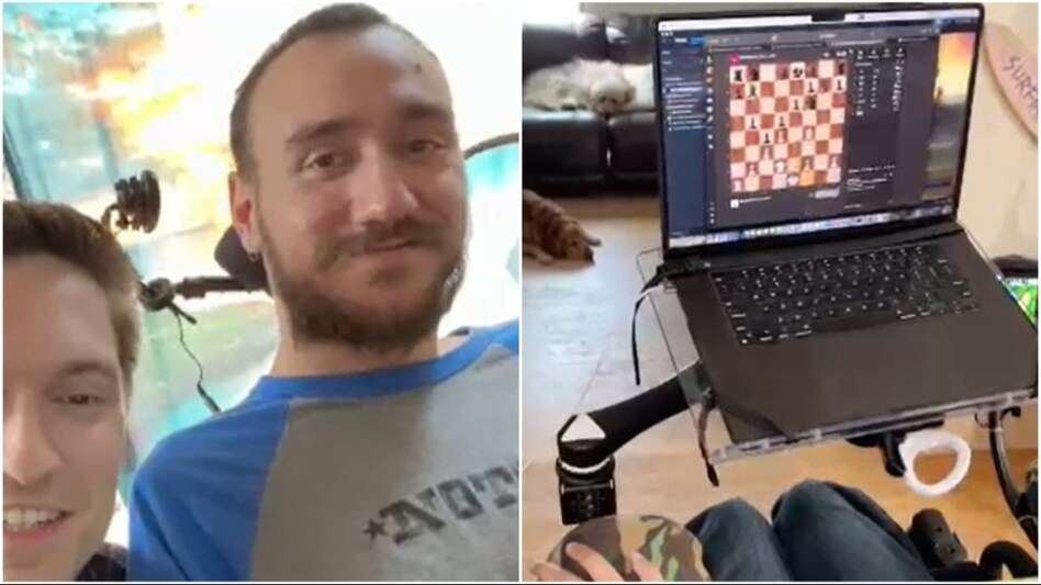 World's first Neuralink patient, Noland Arbaugh, is able to control a computer and play games just by thinking (Video screengrabs/@neuralink) World's first Neuralink patient, Noland Arbaugh, is able to control a computer and play games just by thinking (Video screengrabs/@neuralink)