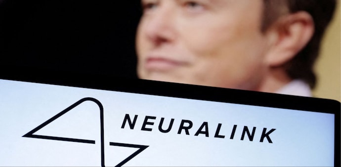Elon Musk's Neuralink has invented a brain chip that is being test on a human being Elon Musk's Neuralink has invented a brain chip that is being test on a human being