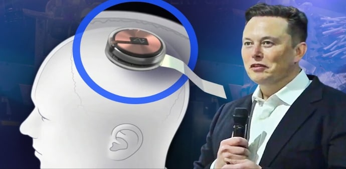 Neuralink Neuralink