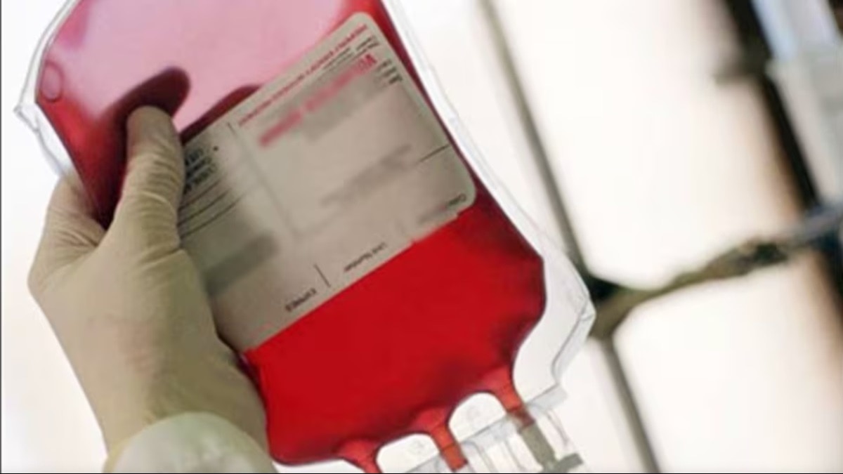 Factor VIII was produced by combining plasma from thousands of donations, meaning that if even one donor was infected, the entire batch could be compromised. Factor VIII was produced by combining plasma from thousands of donations, meaning that if even one donor was infected, the entire batch could be compromised.