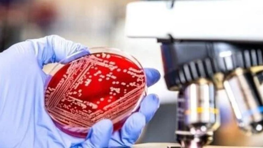 India lags in antibacterial research amid mounting global antimicrobial resistance crisis