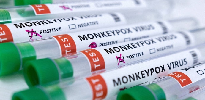 Monkeypox: Prithviraj Chavan calls for strict screening at Mumbai airport Monkeypox: Prithviraj Chavan calls for strict screening at Mumbai airport