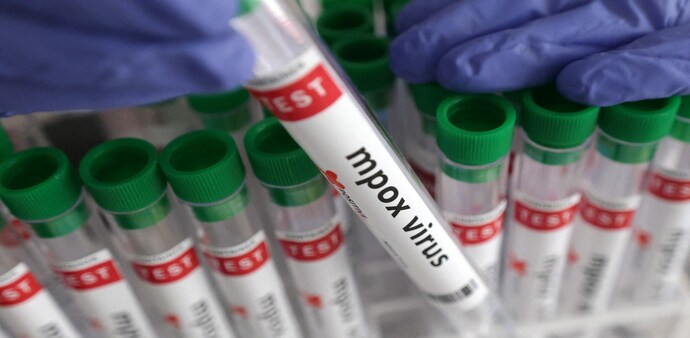 Health insurance policies generally provide coverage for Monkeypox under their standard provisions for infectious diseases. Health insurance policies generally provide coverage for Monkeypox under their standard provisions for infectious diseases.