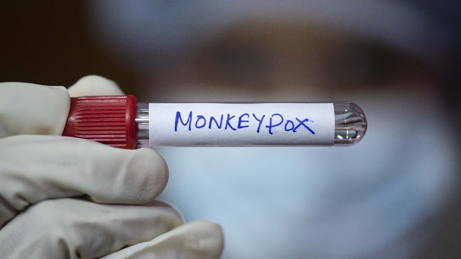 Monkeypox (Mpox) is a viral disease that spreads through close contact with an infected person. Monkeypox (Mpox) is a viral disease that spreads through close contact with an infected person.