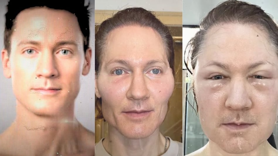 Bryan Johnson face experiment goes wrong Bryan Johnson face experiment goes wrong