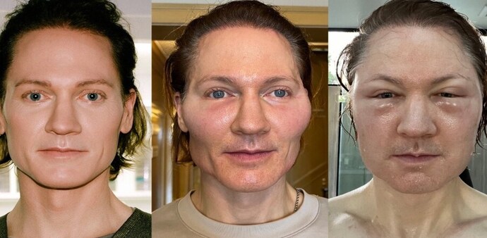 Johnson's, 45, anti-aging experiments include receiving blood transfusions from his teenage son and adhering to a strict regimen of diet, sleep, and exercise. Johnson's, 45, anti-aging experiments include receiving blood transfusions from his teenage son and adhering to a strict regimen of diet, sleep, and exercise.