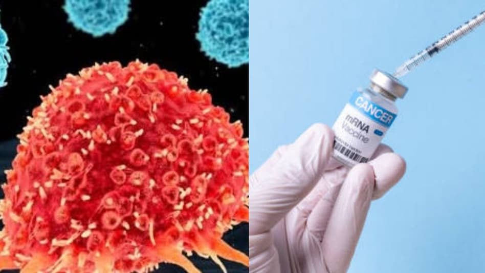 Russia's New mRNA Cancer Vaccine Set for 2025 Launch Russia's New mRNA Cancer Vaccine Set for 2025 Launch