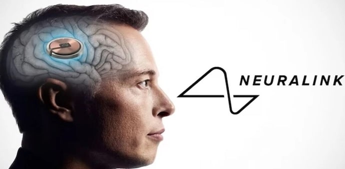Elon Musk's company will soon implant a second chip. Elon Musk's company will soon implant a second chip.
