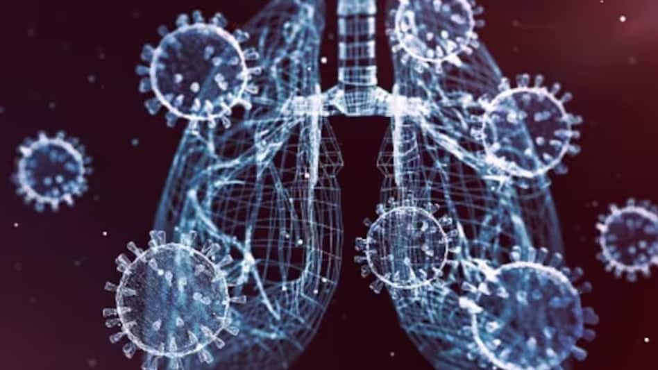 While some worry that HKU5-CoV-2 could spark another global health crisis, there is no evidence yet that it can spread between humans. While some worry that HKU5-CoV-2 could spark another global health crisis, there is no evidence yet that it can spread between humans.