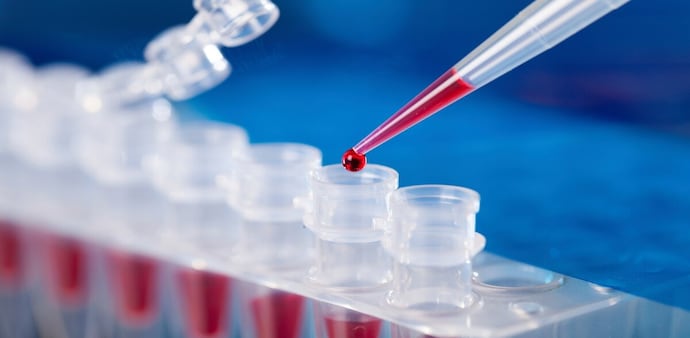 Clinical trials are now underway at Sakai’s lab, with volunteers receiving between 100 and 400 milliliters of the artificial blood. Clinical trials are now underway at Sakai’s lab, with volunteers receiving between 100 and 400 milliliters of the artificial blood.