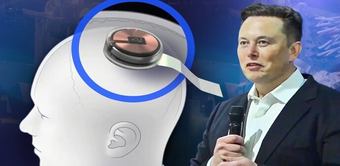 Neuralink Neuralink