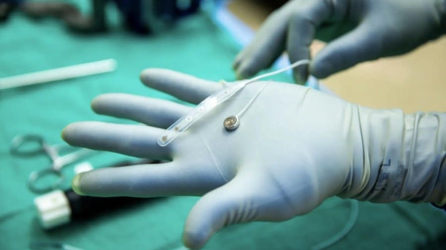 A brain-computer interface (BCI) A brain-computer interface (BCI)