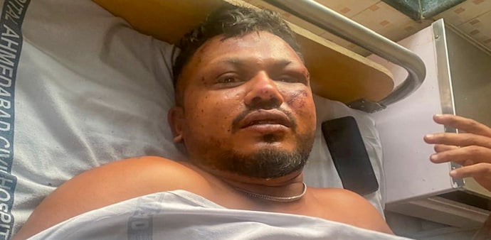 Ramesh’s story isn’t just mechanics and odds; it’s a testament to human will. Ramesh’s story isn’t just mechanics and odds; it’s a testament to human will.