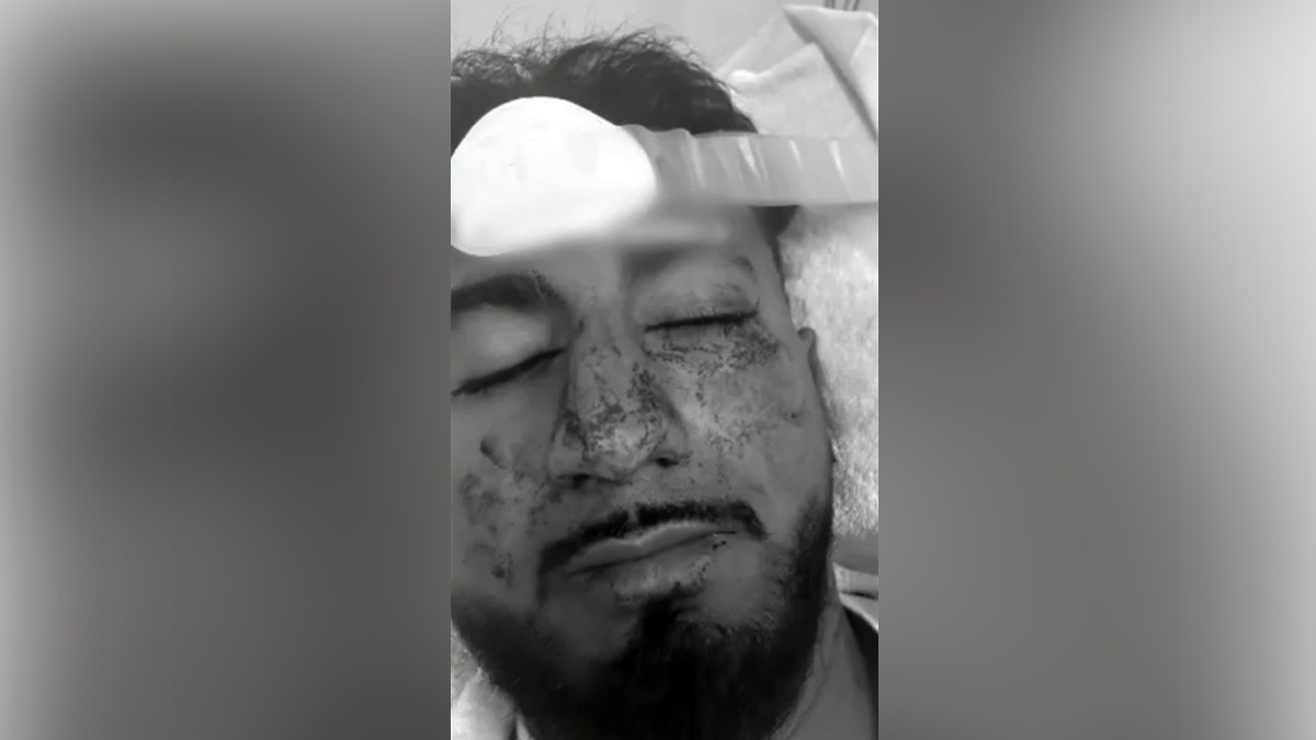 Charanpreet Singh, who suffered brain trauma and multiple facial fractures.