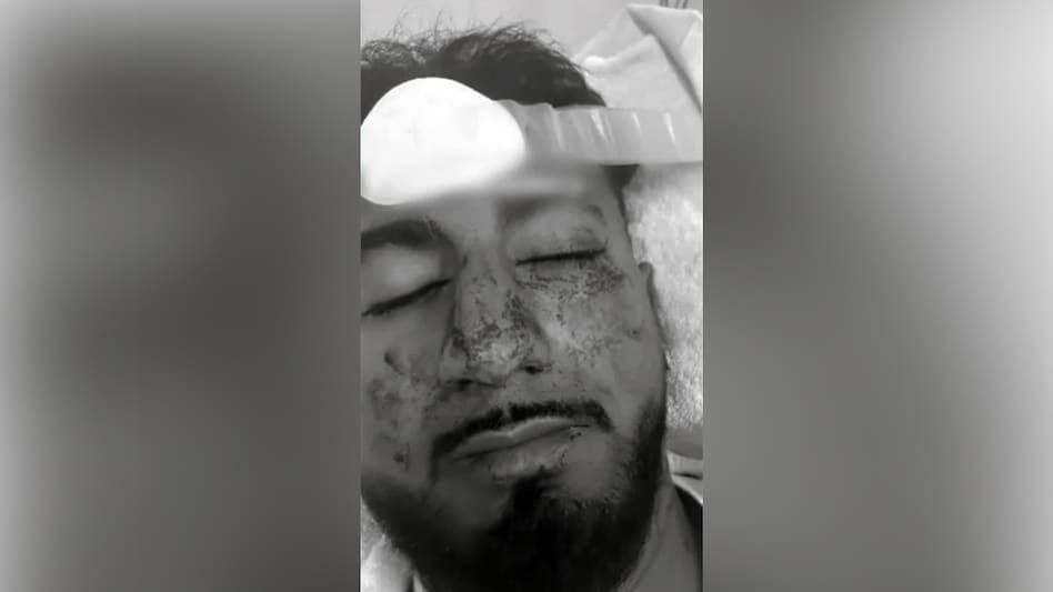 Charanpreet Singh, who suffered brain trauma and multiple facial fractures. Charanpreet Singh, who suffered brain trauma and multiple facial fractures.
