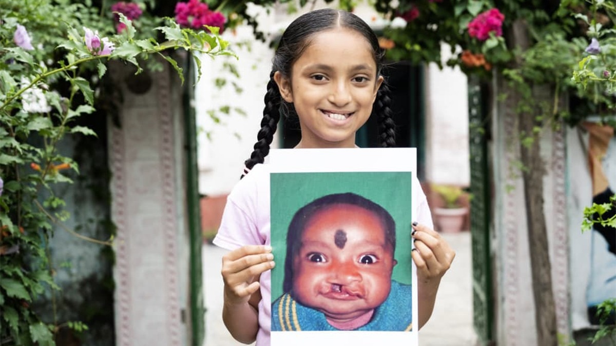 RBSK ensures screening and management for child health through the 4Ds approach RBSK ensures screening and management for child health through the 4Ds approach