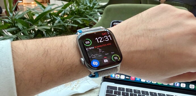 Apple Watch Series 11 Apple Watch Series 11