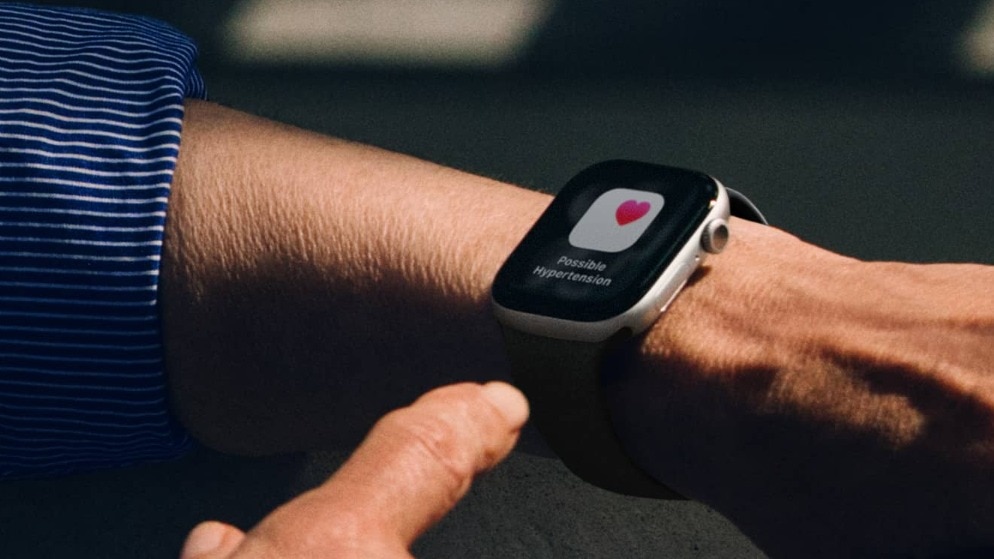 Apple Watch Series 11