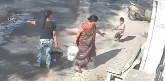The boy has been hospitalised after 45 per cent burns. (Photo:X/MihirkJha) The boy has been hospitalised after 45 per cent burns. (Photo:X/MihirkJha)