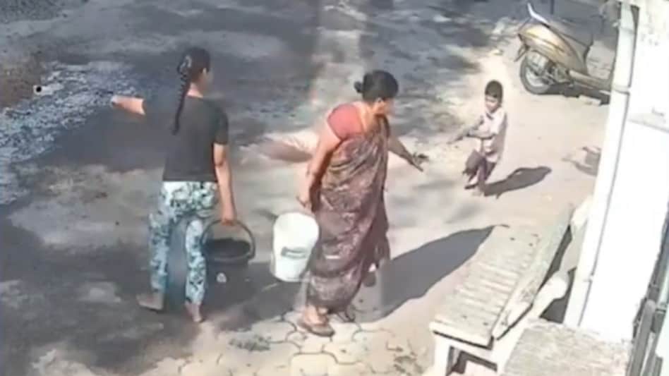 The boy has been hospitalised after 45 per cent burns. (Photo:X/MihirkJha) The boy has been hospitalised after 45 per cent burns. (Photo:X/MihirkJha)