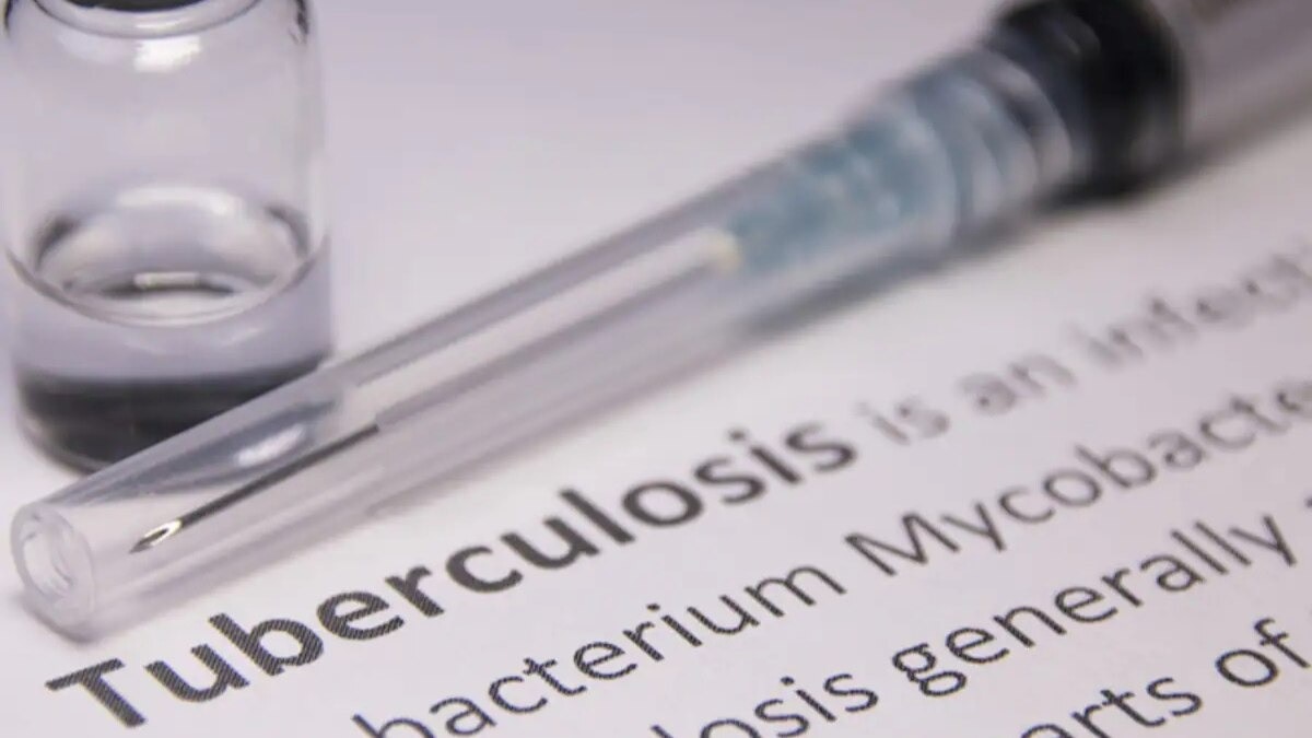 Global logistics disruptions raise concerns over TB drug supply in India