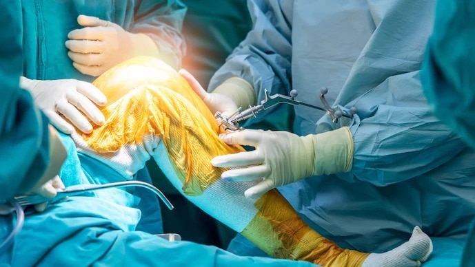 India performs an estimated 2.5 lakh to 3.5 lakh joint replacement surgeries every year.