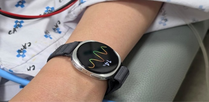 Samsung Galaxy Watch 6 was used to predict a common type of fainting. Samsung Galaxy Watch 6 was used to predict a common type of fainting.
