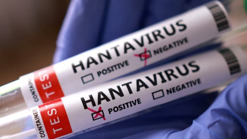 WHO chief calms Tenerife fears as hantavirus cruise ship nears island WHO chief calms Tenerife fears as hantavirus cruise ship nears island