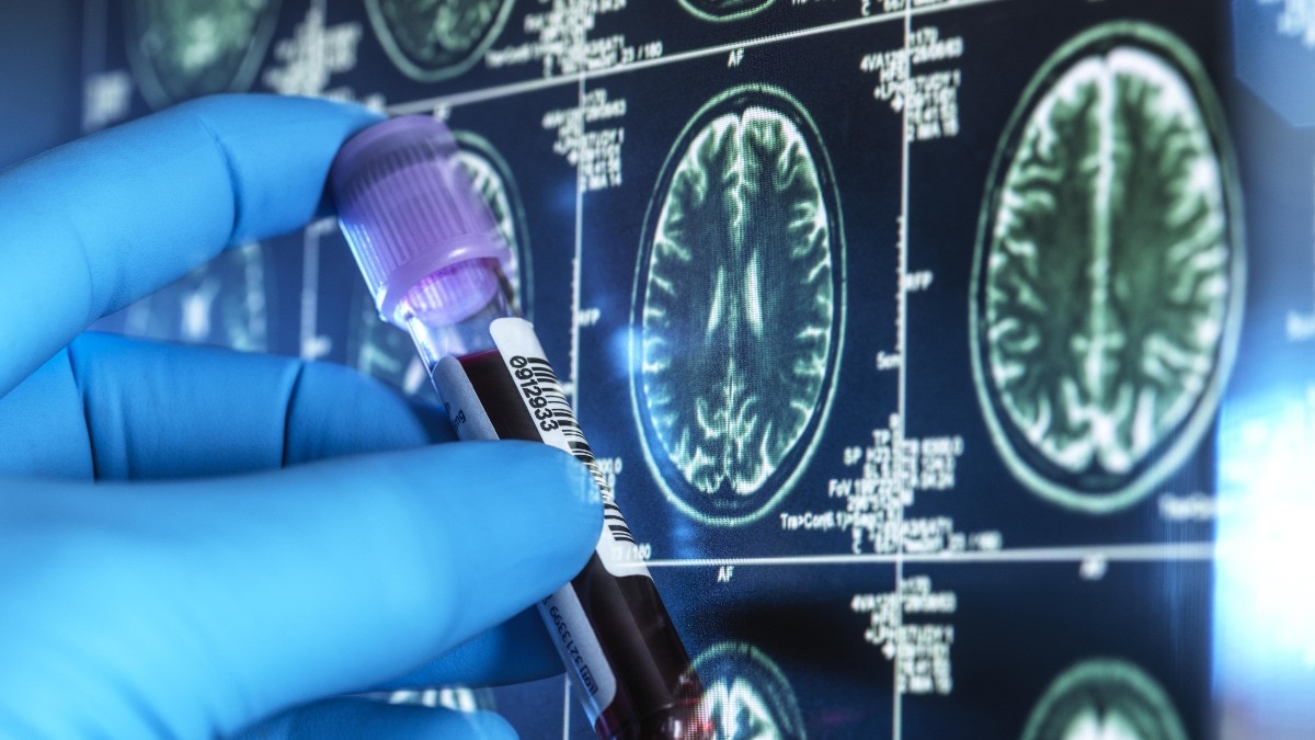 The launch comes at a time when India is witnessing a rapid rise in dementia cases driven by an ageing population, low awareness and delayed diagnosis. 