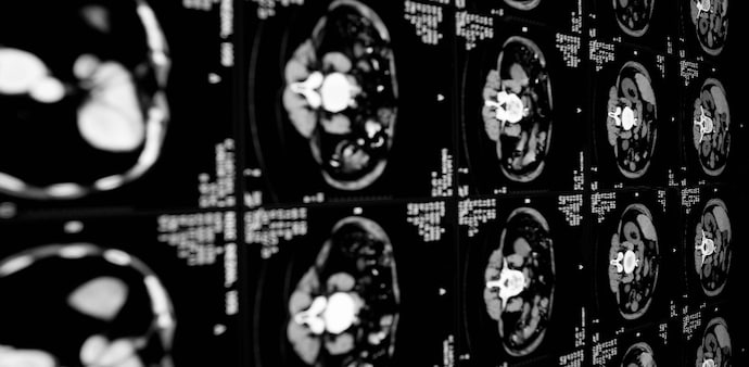 IGI said preclinical animal studies showed favourable safety, tolerability and pharmacokinetic data, indicating the drug remained in the body long enough to potentially exert therapeutic activity. IGI said preclinical animal studies showed favourable safety, tolerability and pharmacokinetic data, indicating the drug remained in the body long enough to potentially exert therapeutic activity.