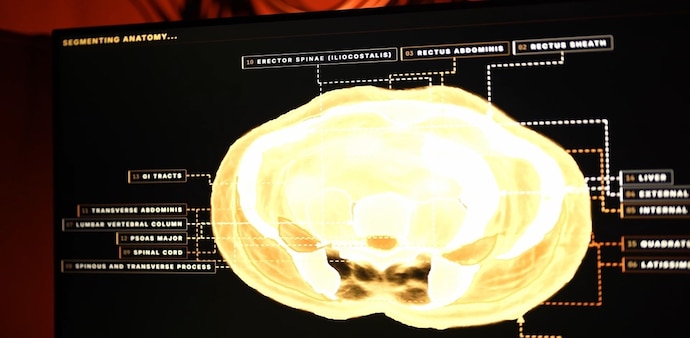 Midjourney’s expansion beyond generative AI into healthcare technology Midjourney’s expansion beyond generative AI into healthcare technology