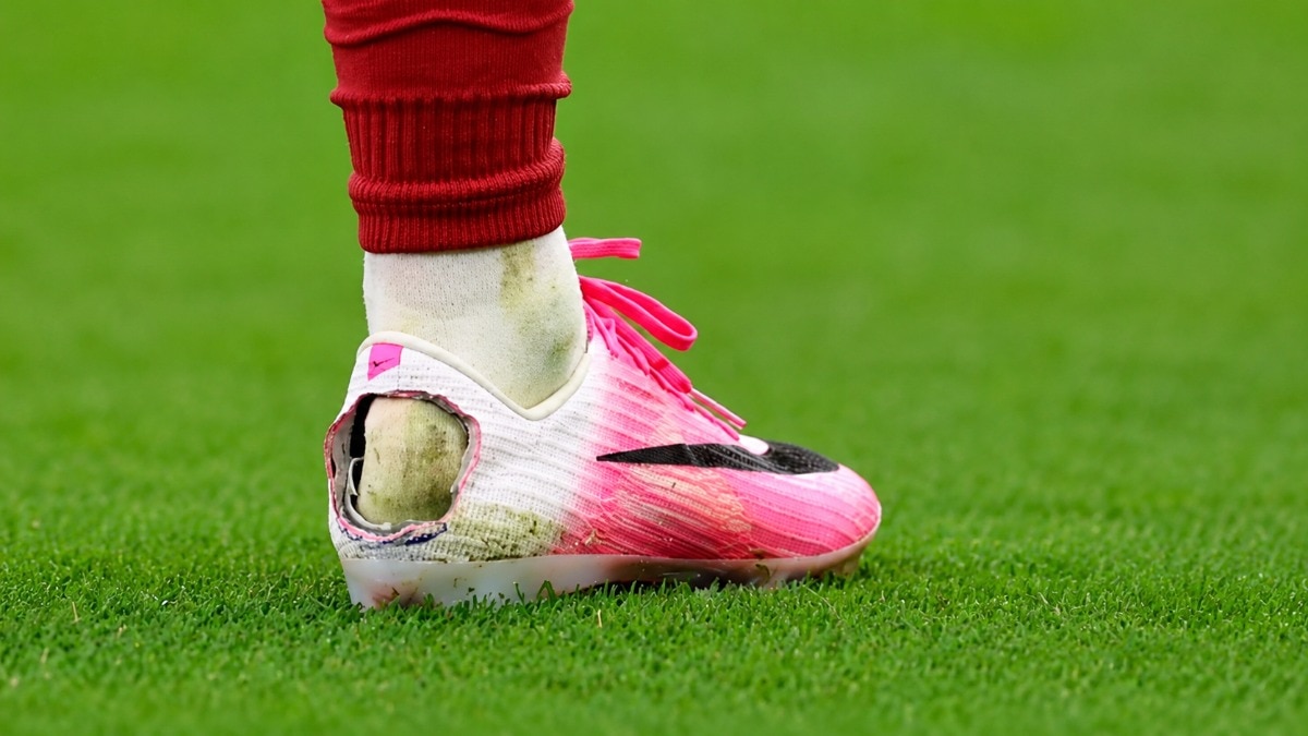 One condition that has been widely discussed during this year's World Cup is Haglund's syndrome.  (Picture credit : WIRED)
