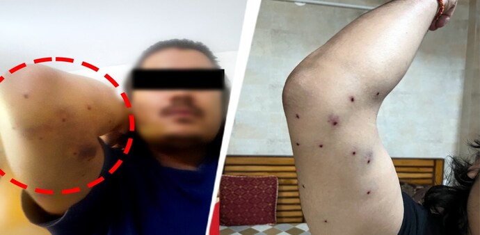 The internal probe comes as hospital records and student testimonies confirm multiple cases of severe pellet wounds among demonstrators. The internal probe comes as hospital records and student testimonies confirm multiple cases of severe pellet wounds among demonstrators.