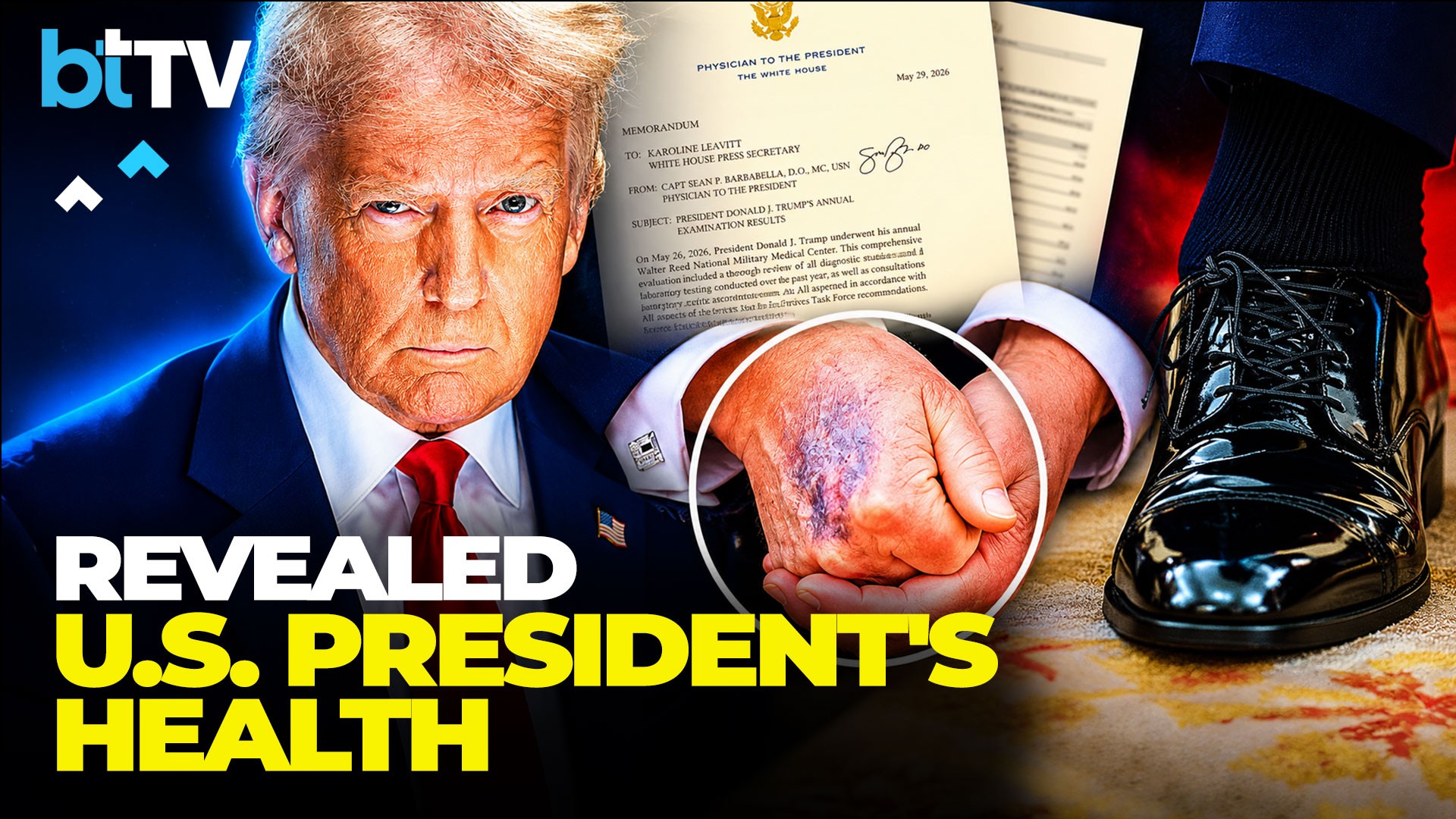 U.S. President Donald Trump’s Medical Secrets Revealed: What The White House Doctor's Report Says