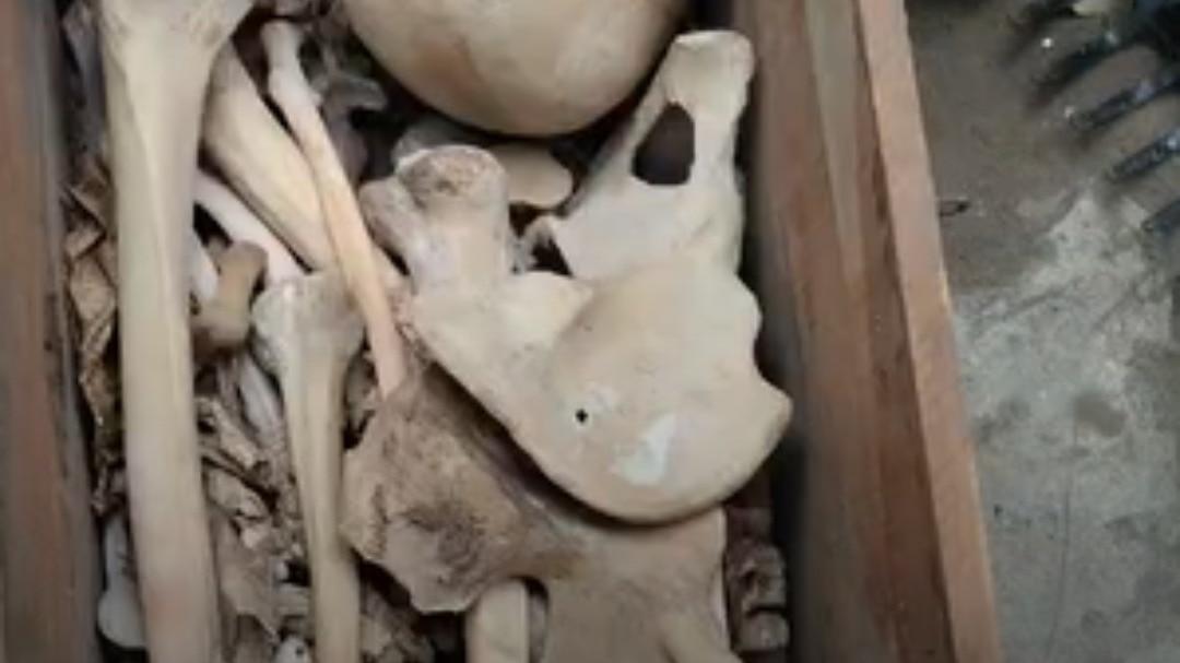 Artificial skeleton triggers panic at Kali temple