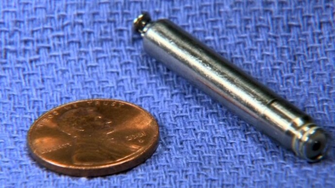 First leadless pacemaker in US implanted into patient - India Today