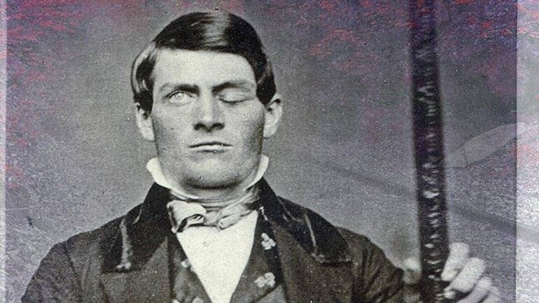 Medical Miracles - Education Today News